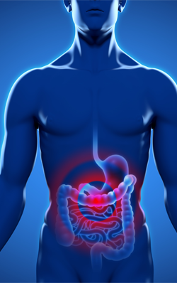 irritable-bowel-syndrome-introduction